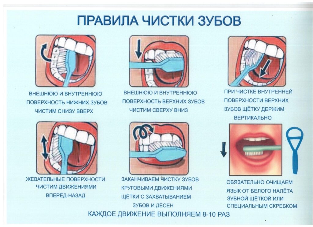 Правила ухода за полостью рта